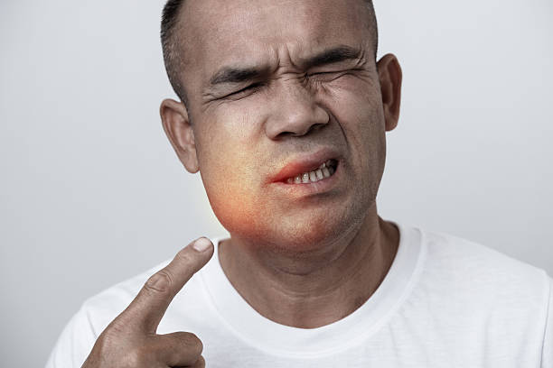 Teeth Tartar Singing Stroke & Heart Attack Anthem – 1