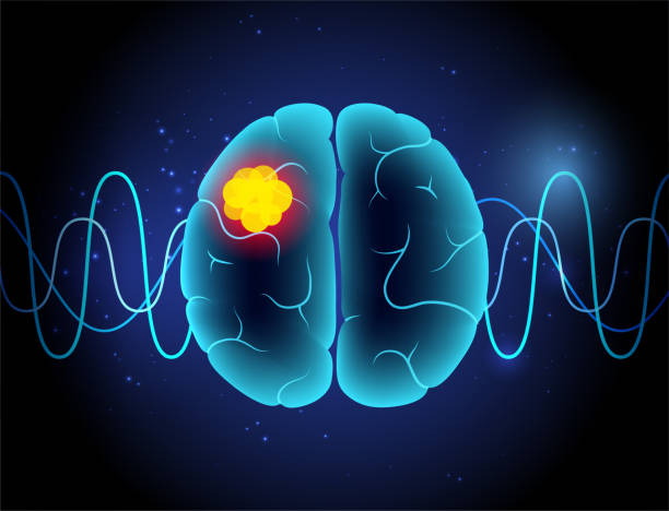 Electric Field Device Combined with Immunotherapy and Chemotherapy Offers New Hope for Glioblastoma Patients