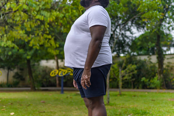 Obesity and Metabolic Syndrome in Male Patients